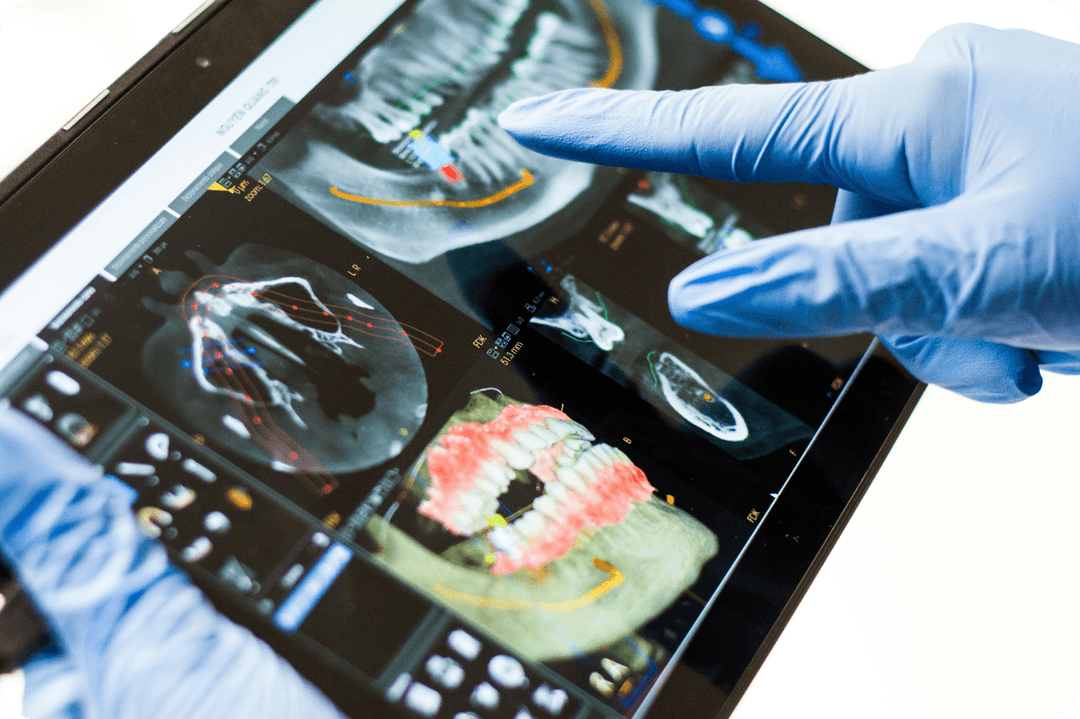 3D CT (CBCT) felvétel