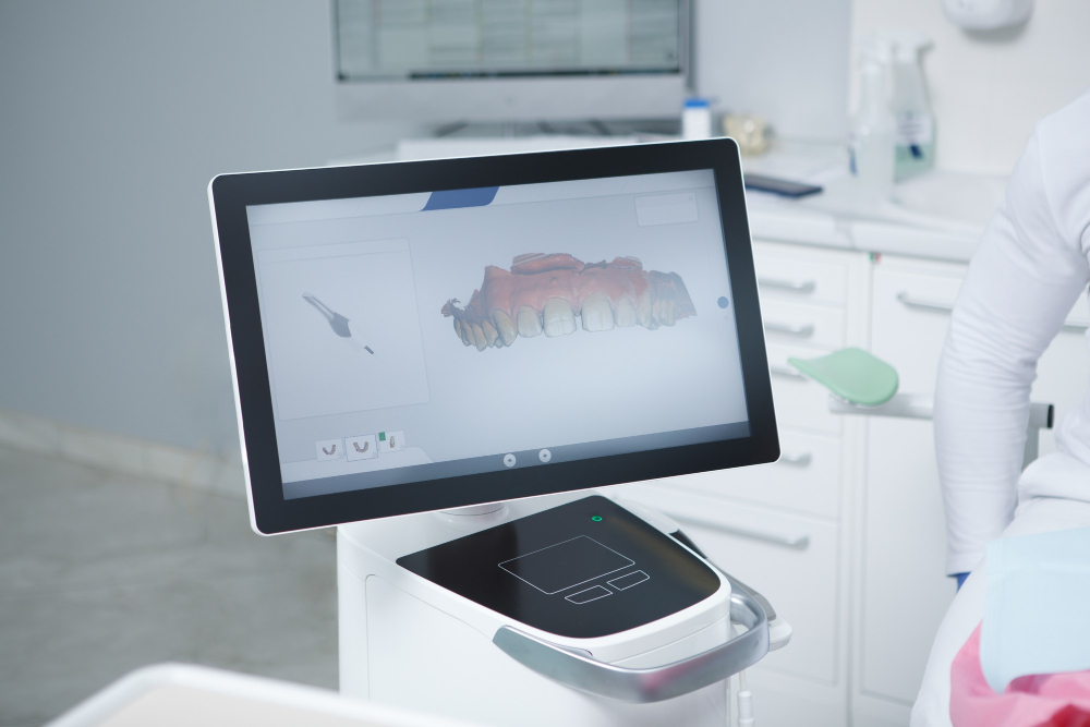 Digitális Mosolytervezés-Digital Smile Design eljárás Budapesten